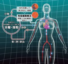 今、注目のがん治療、がん免疫治療　がん免疫細胞療法セミナーを福岡で開催　新聞、テレビでセミナーでの講演を公開