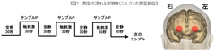 図1　測定の流れとNIRS(ニルス)の測定部位