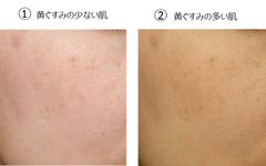 老化による肌の「黄ぐすみ」にニトロ化が関与！ニトロ化抑制・減少成分「碁石茶エキス」配合化粧品発売へ