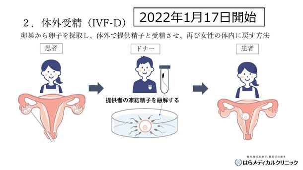 国内初 精子バンク利用による非配偶者間体外受精顕微授精 IVF D を開始 プレスリリース コラムニューズウィーク日本版