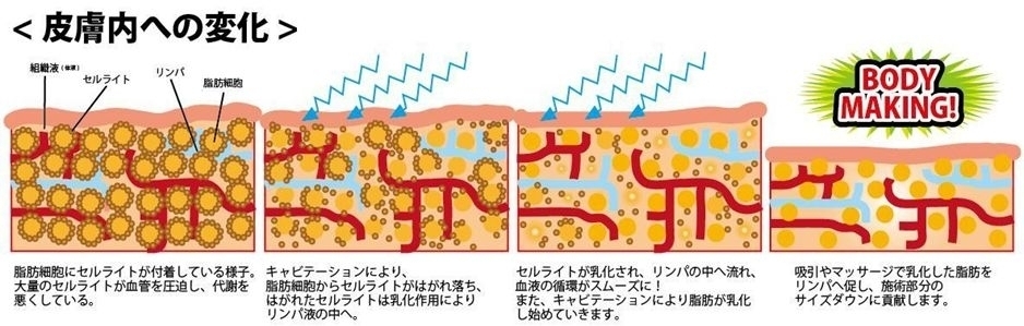 リラックスコーポレーション、“キャビテーション＋EMS 痩身コース”を9,880円でサービス開始！｜株式会社リラックスコーポレーションのプレスリリース