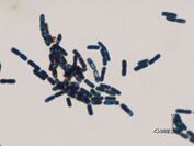 セレウス菌(Bacilluscereus)