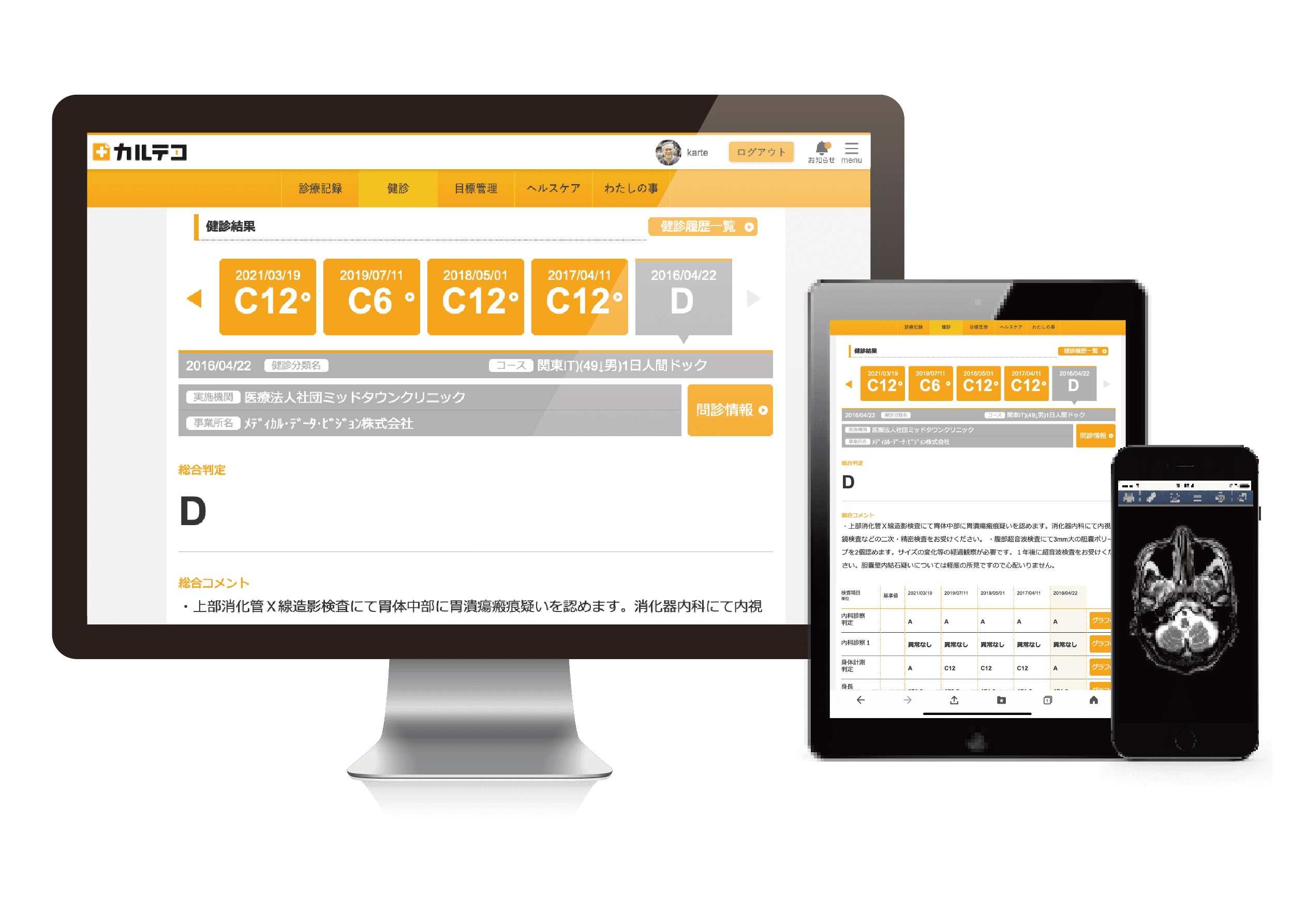 健診版PHRサービス「カルテコ」、リリース　検査結果の経年比較容易に、施設内オペレーション効率化