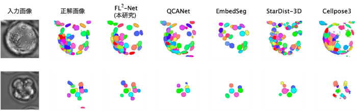 生まれる可能性の高い受精卵を81.63％の精度で予測するAI開発に成功　－体外受精の成功率向上に寄与－