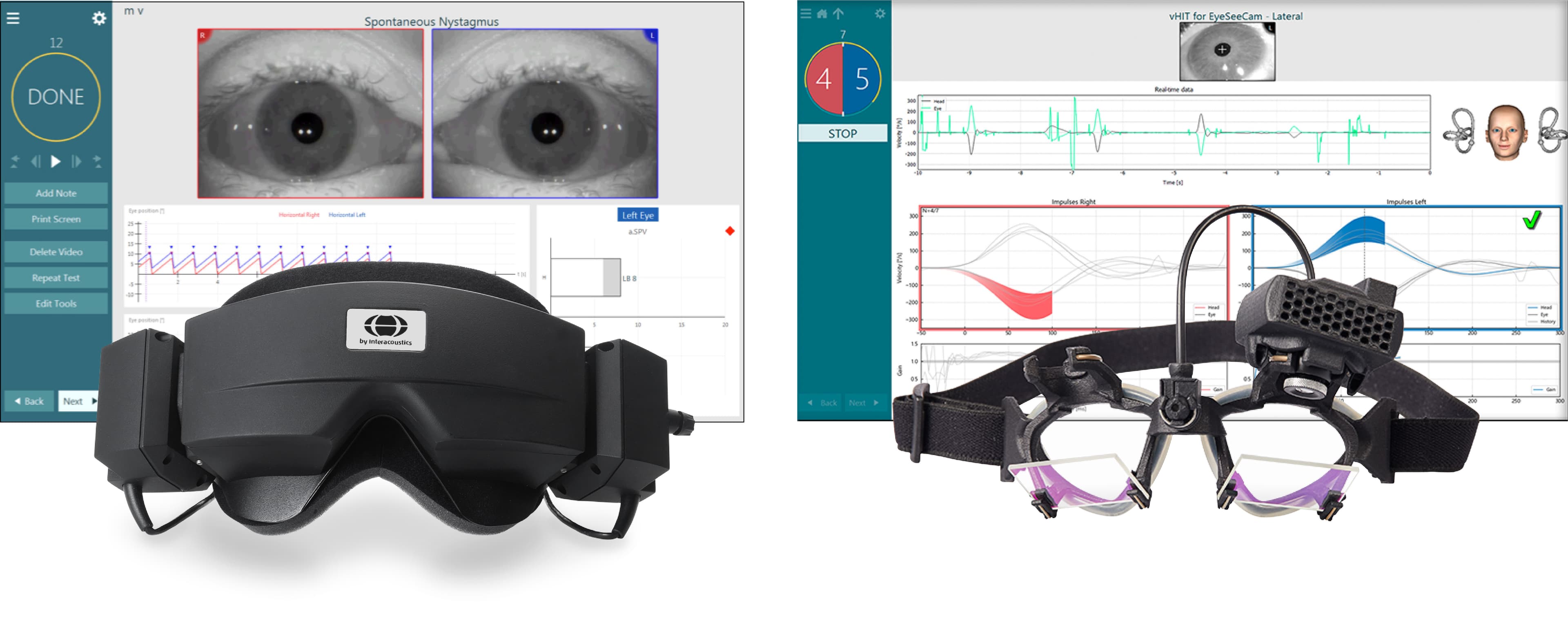 ダイアテックカンパニー、VNGおよびvHITを1台へ統合した、 眼球運動検査装置「VisualEyes 3.0(第3世代)」を5月16日に発売