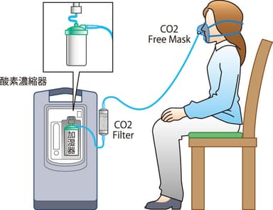shenpix CO2 Free System
