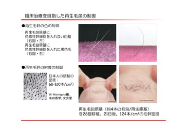 再生毛包制御