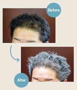 Before→After