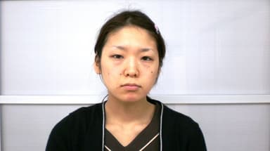 施術前