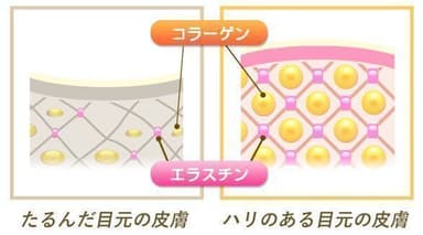 アプローチ(2)