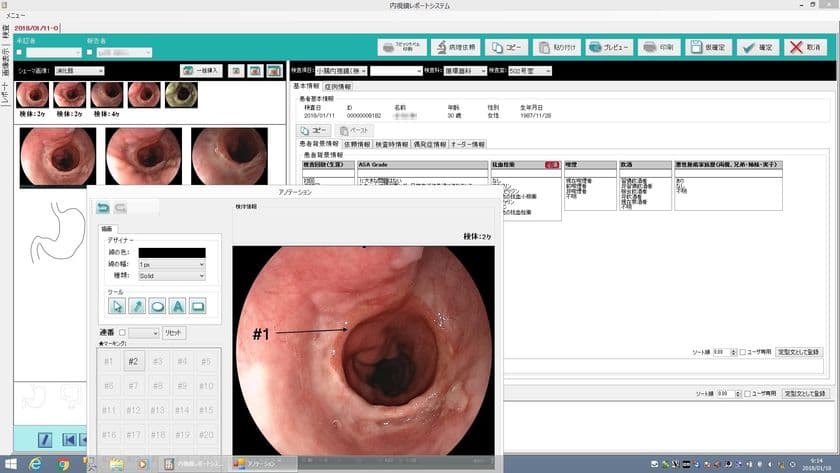 院内のワークフローにマッチする
クラウドサーバ対応可能な消化器内視鏡レポートシステム販売開始