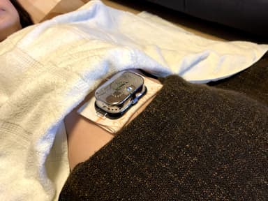 妊娠力の底上げを助ける「へそ温灸」