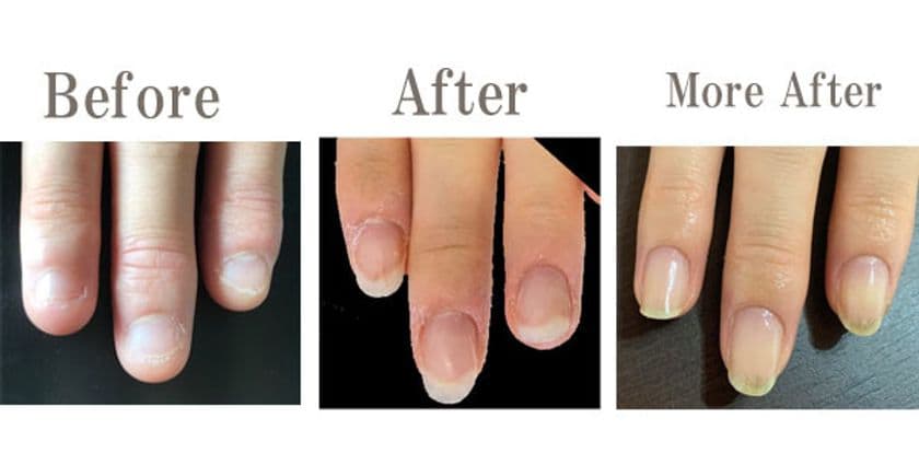 『NAIL CLINIQUE』をリニューアル！
健康で綺麗に育てる「爪育成」に特化した
爪の専門店として12月から運営開始