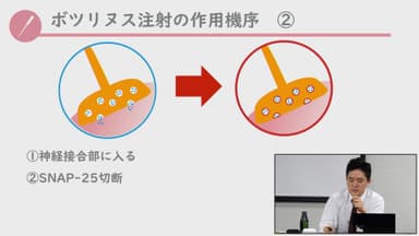 ボツリヌス注射の作用機序