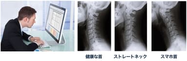 首を酷使して不調気味の現代人