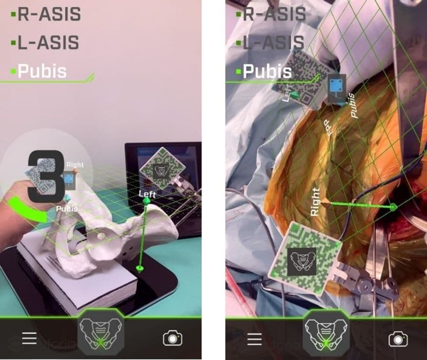 浅草病院、AR(拡張現実)技術を用いた人工股関節手術を開始