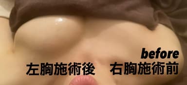 バストアップ技術(1)