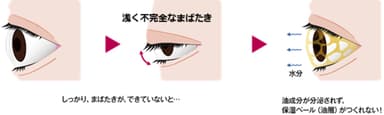 不完全なまばたき