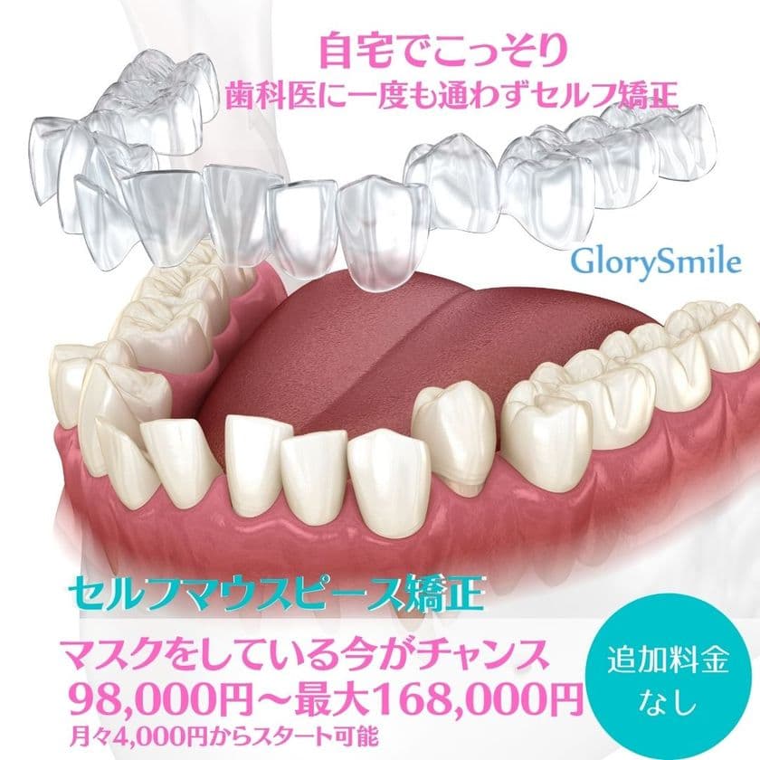歯科医院に一度も行かずに歯の矯正が安価でできる　
セルフマウスピース矯正「GlorySmile」を3月1日より提供開始