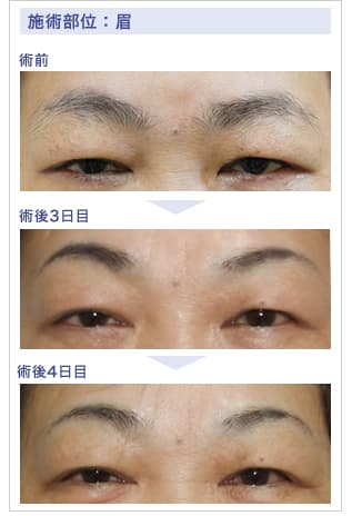 症例