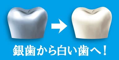 銀歯から白い歯へ！