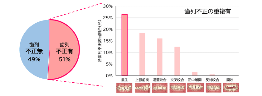 ライオン×青森県黒石市×弘前大学の共同研究　
歯並びの状態と日常の生活習慣や癖が関係する可能性を確認