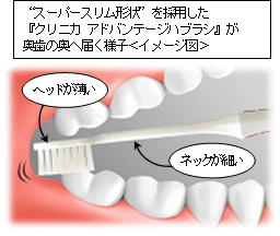 クリニカ アドバンテージハブラシが「奥歯の奥」まで届く様子