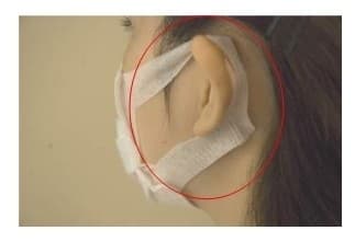 伸縮素材の耳かけ