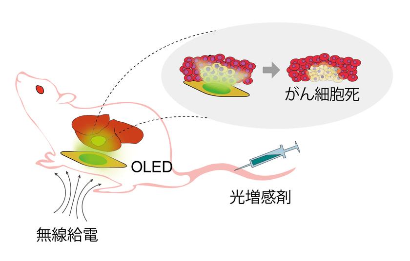 ワイヤレスで駆動する有機EL(OLED)により
新しい光がん治療法を実現　
～深部臓器がんへの新たな治療アプローチ～