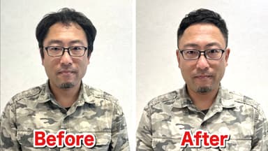 M字薄毛をカットで改善(3)