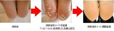 足の変化