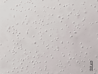 一般家庭の追いだき配管から採取した残湯を光学顕微鏡でみた様子1