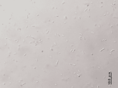 一般家庭の追いだき配管から採取した残湯を光学顕微鏡でみた様子2