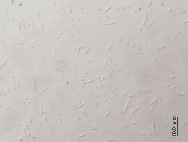 一般家庭の追いだき配管から採取した残湯を光学顕微鏡でみた様子3