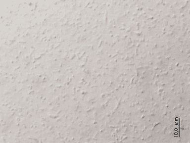 一般家庭の追いだき配管から採取した残湯を光学顕微鏡でみた様子4