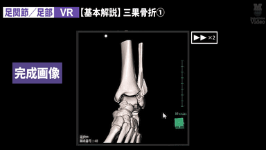 足関節