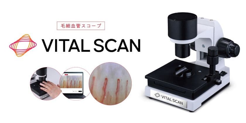 血行に着目した健康意識向上の取り組み　
毛細血管スコープ「VITAL SCAN(バイタルスキャン)」販売開始