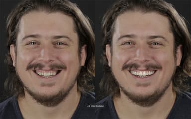 ビフォー＆アフター