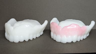 日本初、入れ歯型マウスピース