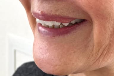 白一色の装着時