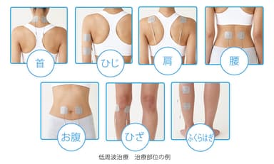 低周波治療