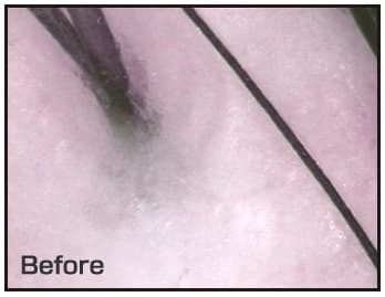 頭皮血行Before