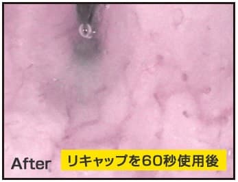 頭皮血行After