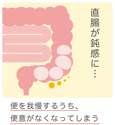 直腸性便秘