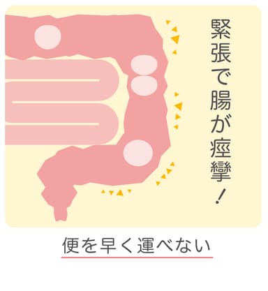 痙攣性便秘