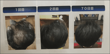 効果実例