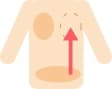 乳腺再建脂肪注入法
