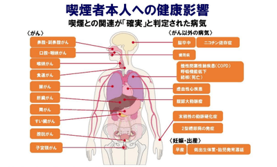 0Mt16lyi9FM9M7wjx4uT.png?w=940&h=940