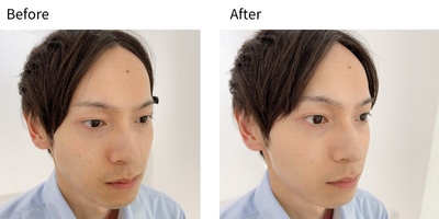 0ctFBrA1qveyLTkqqUou.jpg?w=940&h=940