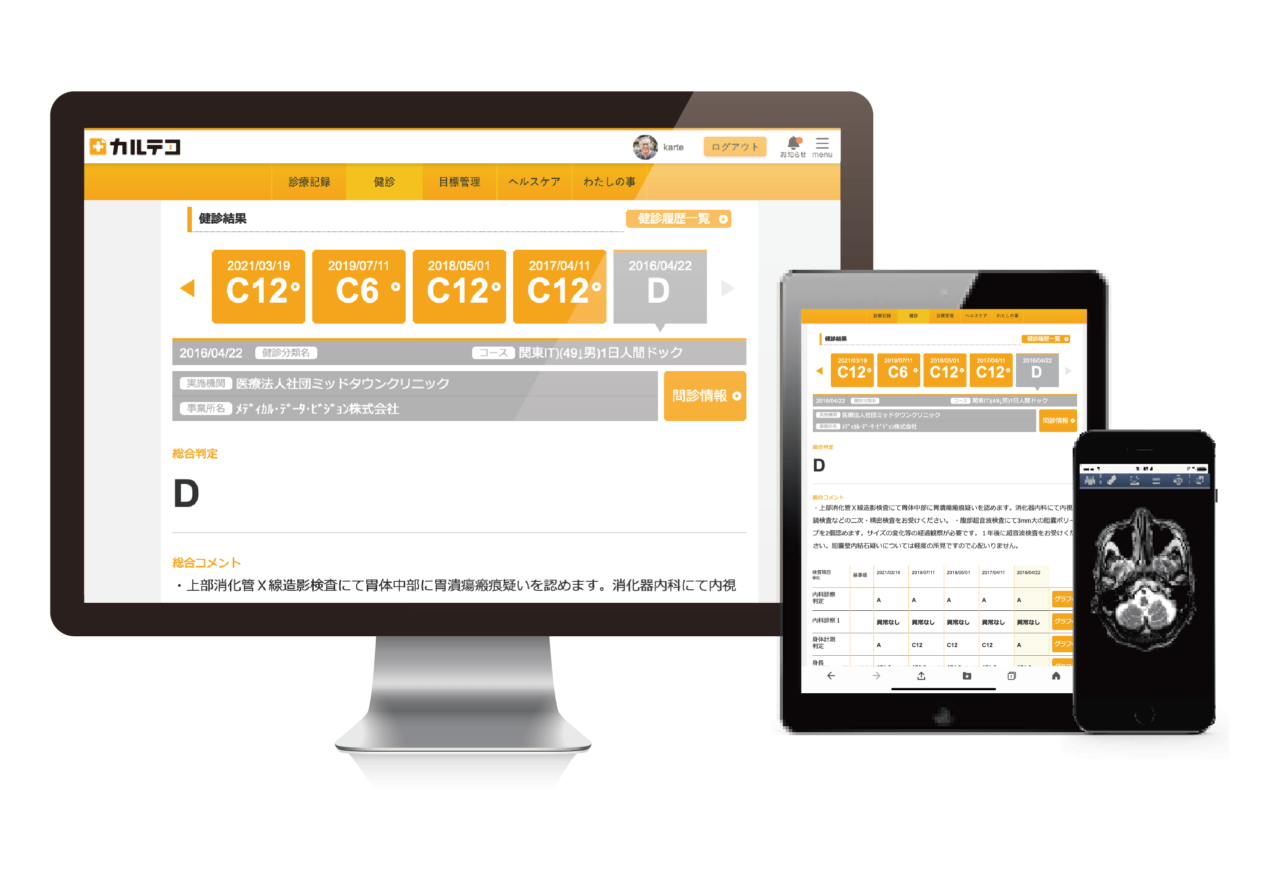 健診版PHRサービス「カルテコ」、リリース 検査結果の経年比較容易に、施設内オペレーション効率化